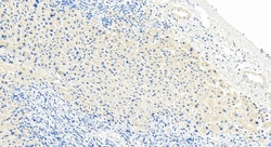 Galectin 8 Rabbit Polyclonal Antibody, Proteintech:Antibodies:Primary Antibodies