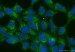 Galectin 8 Rabbit Polyclonal Antibody, Proteintech:Antibodies:Primary Antibodies