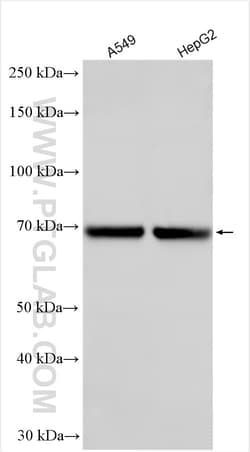 LILRA2 Rabbit Polyclonal Antibody, Proteintech Unconjugated; 150 &mu;L:Antibodies,