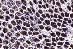 LIMK1 Mouse Monoclonal Antibody, Proteintech Unconjugated; 20 &mu;L:Antibodies,