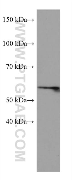 LIMK1 Mouse Monoclonal Antibody, Proteintech Unconjugated; 20 &mu;L:Antibodies,
