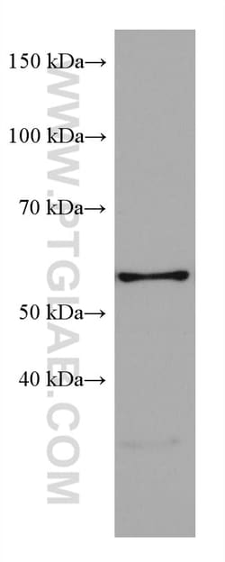 LIMK1 Mouse Monoclonal Antibody, Proteintech Unconjugated; 20 &mu;L:Antibodies,