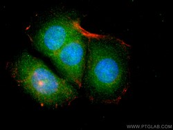 LMCD1 Mouse Monoclonal Antibody, Proteintech Unconjugated; 150 &mu;L:Antibodies,