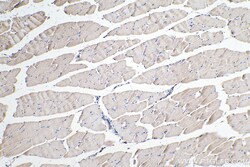 LMCD1 Mouse Monoclonal Antibody, Proteintech Unconjugated; 150 &mu;L:Antibodies,