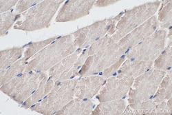 LMCD1 Mouse Monoclonal Antibody, Proteintech Unconjugated; 150 &mu;L:Antibodies,