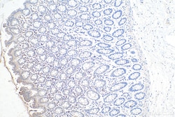 LMCD1 Mouse Monoclonal Antibody, Proteintech Unconjugated; 150 &mu;L:Antibodies,