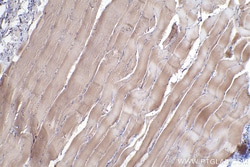 LMCD1 Mouse Monoclonal Antibody, Proteintech Unconjugated; 150 &mu;L:Antibodies,