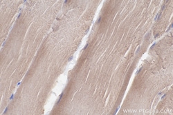 LMCD1 Mouse Monoclonal Antibody, Proteintech Unconjugated; 150 &mu;L:Antibodies,