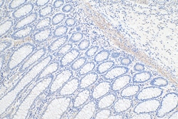 LMCD1 Mouse Monoclonal Antibody, Proteintech Unconjugated; 150 &mu;L:Antibodies,