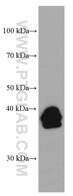 LMCD1 Mouse Monoclonal Antibody, Proteintech Unconjugated; 150 &mu;L:Antibodies,