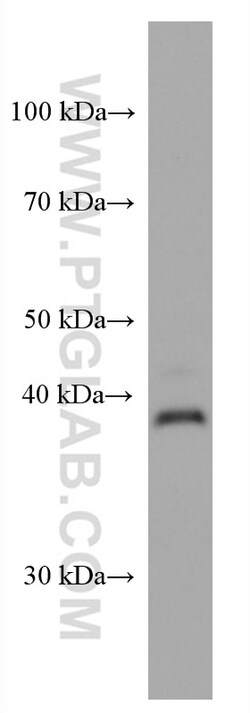 LMCD1 Mouse Monoclonal Antibody, Proteintech Unconjugated; 150 &mu;L:Antibodies,