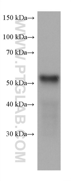 LPCAT3 Mouse Monoclonal Antibody, Proteintech Unconjugated; 150 &mu;L:Antibodies,