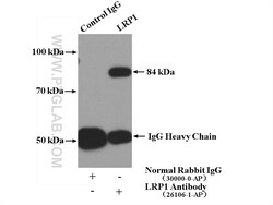 LRP1 Rabbit Polyclonal Antibody, Proteintech 150 &mu;L | Buy Online | Proteintech | Fisher Scientific