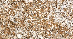 LRP1 Rabbit Polyclonal Antibody, Proteintech Unconjugated; 150 &mu;L:Antibodies,