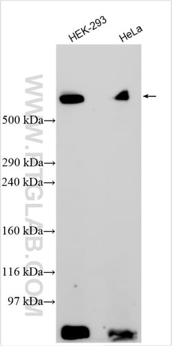 LRP1 Rabbit Polyclonal Antibody, Proteintech Unconjugated; 150 &mu;L:Antibodies,