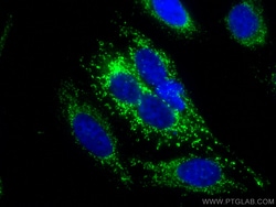 LRPPRC Mouse Monoclonal Antibody, Proteintech Unconjugated; 20 &mu;L:Antibodies,
