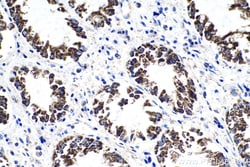 LRPPRC Mouse Monoclonal Antibody, Proteintech Unconjugated; 20 &mu;L:Antibodies,