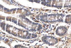 LSM6 Rabbit Polyclonal Antibody, Proteintech Unconjugated; 150 &mu;L:Antibodies,