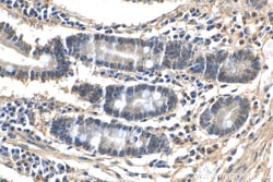 LSM6 Rabbit Polyclonal Antibody, Proteintech Unconjugated; 150 &mu;L:Antibodies,