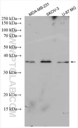 LUZP4 Rabbit Polyclonal Antibody, Proteintech Unconjugated; 150 &mu;L:Antibodies,