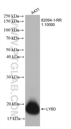 LY6D Rabbit Recombinant Antibody, Proteintech:Antibodies:Primary Antibodies