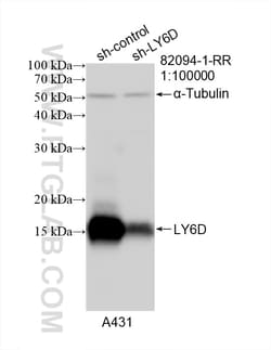 LY6D Rabbit Recombinant Antibody, Proteintech:Antibodies:Primary Antibodies