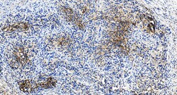 LYPD1 Rabbit Polyclonal Antibody, Proteintech Unconjugated; 150 &mu;L:Antibodies,