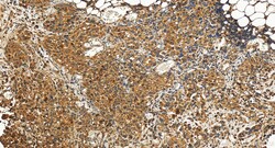 MADD Rabbit Polyclonal Antibody, Proteintech 150 &mu;L | Buy Online | Proteintech | Fisher Scientific