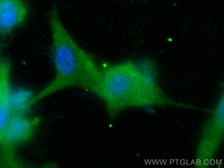 MAGI2 Rabbit Polyclonal Antibody, Proteintech:Antibodies:Primary Antibodies