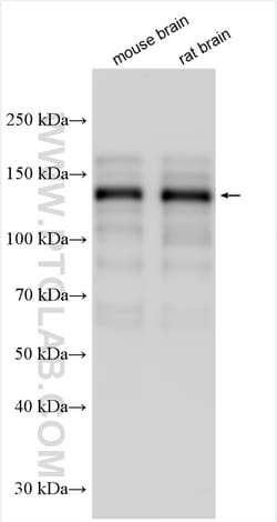 MAGI2 Rabbit Polyclonal Antibody, Proteintech:Antibodies:Primary Antibodies