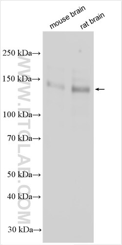MAGI2 Rabbit Polyclonal Antibody, Proteintech:Antibodies:Primary Antibodies
