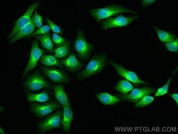 MAN1A1 Rabbit Polyclonal Antibody, Proteintech:Antibodies:Primary Antibodies