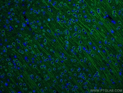 CoraLite Plus 488-conjugated MAP2 Rabbit Polyclonal Antibody, Proteintech