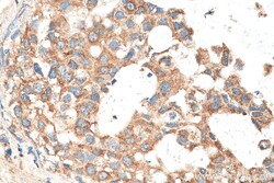 MEKK2 Rabbit Polyclonal Antibody, Proteintech Unconjugated; 20 &mu;L:Antibodies,