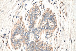 MEKK2 Rabbit Polyclonal Antibody, Proteintech Unconjugated; 20 &mu;L:Antibodies,