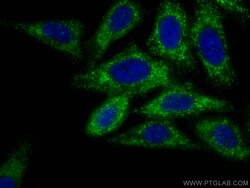TAK1 Mouse Monoclonal Antibody, Proteintech Unconjugated; 20 &mu;L:Antibodies