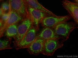TAK1 Mouse Monoclonal Antibody, Proteintech Unconjugated; 20 &mu;L:Antibodies
