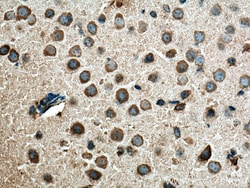 TAK1 Mouse Monoclonal Antibody, Proteintech Unconjugated; 20 &mu;L:Antibodies