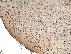 TAK1 Mouse Monoclonal Antibody, Proteintech Unconjugated; 20 &mu;L:Antibodies