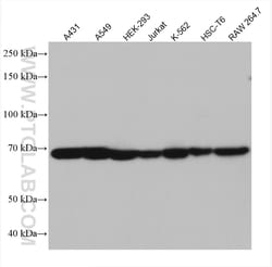 TAK1 Mouse Monoclonal Antibody, Proteintech Unconjugated; 20 &mu;L:Antibodies