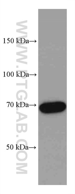 TAK1 Mouse Monoclonal Antibody, Proteintech Unconjugated; 20 &mu;L:Antibodies