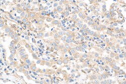 MAP4 Mouse Monoclonal Antibody, Proteintech Unconjugated; 20 &mu;L:Antibodies,