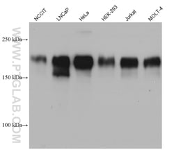 MAP4 Mouse Monoclonal Antibody, Proteintech Unconjugated; 20 &mu;L:Antibodies,