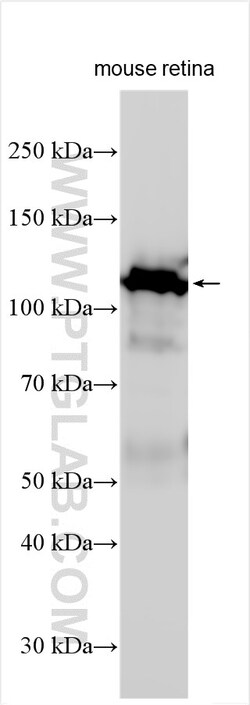 MAP6/STOP Rabbit Polyclonal Antibody, Proteintech Unconjugated; 20 &mu;L:Antibodies,