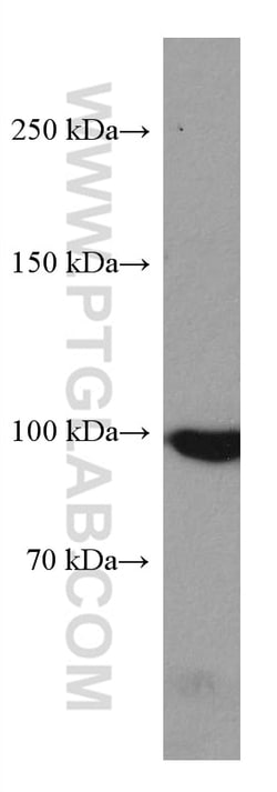 MARS Mouse Monoclonal Antibody, Proteintech Unconjugated; 150 &mu;L:Antibodies,