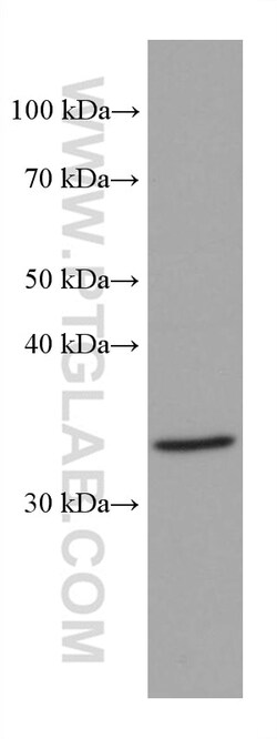 MAT2B Mouse Monoclonal Antibody, Proteintech:Antibodies:Primary Antibodies