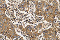 MAVS; VISA Rabbit Recombinant Antibody, Proteintech Unconjugated; 100 &mu;L:Antibodies,
