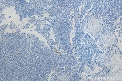 Biotin-conjugated MAdCAM1 Mouse Monoclonal Antibody, Proteintech Biotin;