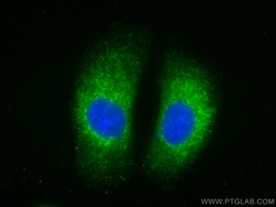 MCL1 Rabbit Recombinant Antibody, Proteintech Unconjugated; 100 &mu;L:Antibodies,