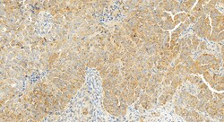 MCL1 Rabbit Recombinant Antibody, Proteintech Unconjugated; 100 &mu;L:Antibodies,